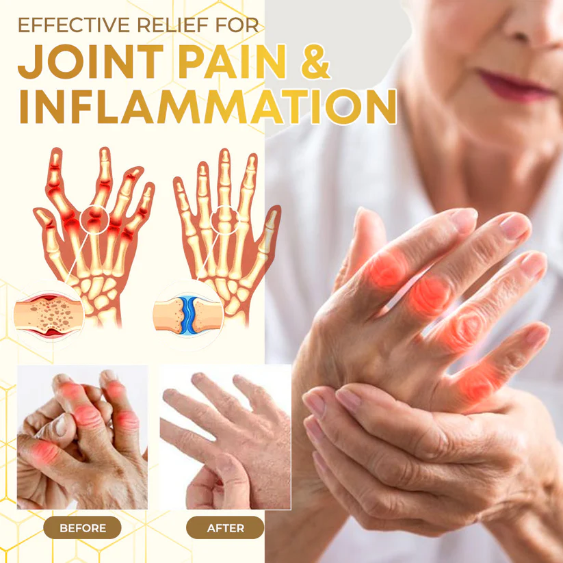 Seurico™ Bee Venom Joint Therapy Pain Relief Gel 6 Seurico™ Bee Venom Joint Therapy Pain Relief Gel