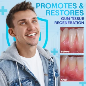 Negusy™ Gum Therapy Agent
