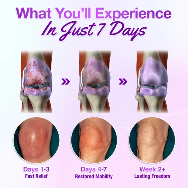Seurico™ Joint Rescue Gel – Turmeric & Emu Oil
