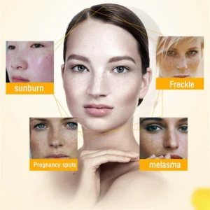 Bloobeac® Blemish Removing Beauty Cream