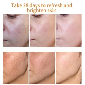 Bloobeac® Blemish Removing Beauty Cream