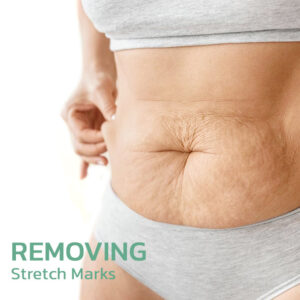 LOVILDS™ CollagenPlus Matrixyl Synthe'6 Lifting Body Oil