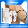Oveallgo™ VeinCare MagAcupoint Reflexology Insole image Oveallgo™ VeinCare MagAcupoint Reflexology Insole