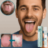 TongueClear™ | Relieves sore tongue and white coating image TongueClear™ | Relieves sore tongue and white coating