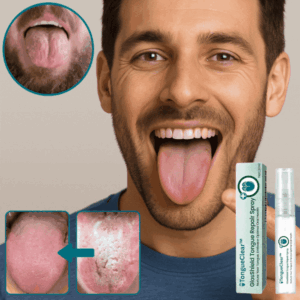 TongueClear™ | Relieves sore tongue and white coating