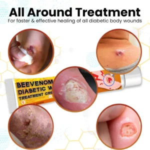 Cvreoz® Bee Venom Diabetic Wounds Treatment Cream image Cvreoz® Bee Venom Diabetic Wounds Treatment Cream