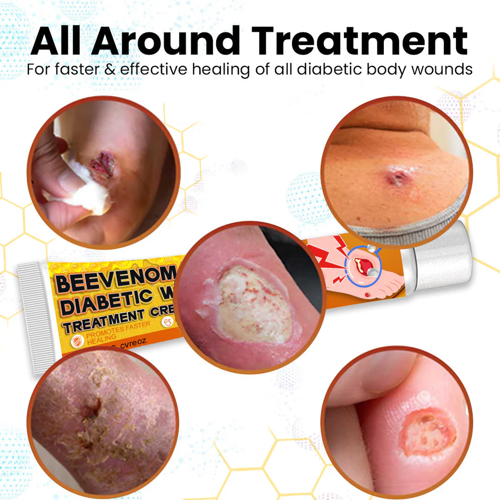 Cvreoz® Bee Venom Diabetic Wounds Treatment Cream image Cvreoz® Bee Venom Diabetic Wounds Treatment Cream