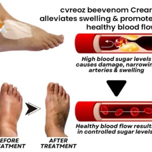 Cvreoz® Bee Venom Diabetic Wounds Treatment Cream image Cvreoz® Bee Venom Diabetic Wounds Treatment Cream