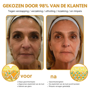 Anti-Wrinkle Botox Wrinkle Removal Cream 13 Anti-Wrinkle™ | Botox Wrinkle Removal Cream