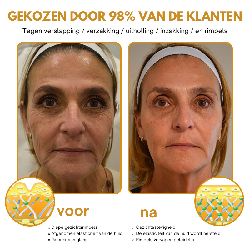 Anti-Wrinkle Botox Wrinkle Removal Cream 2 Anti-Wrinkle™ | Botox Wrinkle Removal Cream