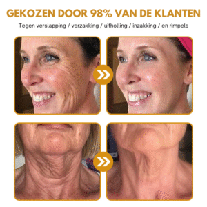 Anti-Wrinkle Botox Wrinkle Removal Cream 18 Anti-Wrinkle™ | Botox Wrinkle Removal Cream