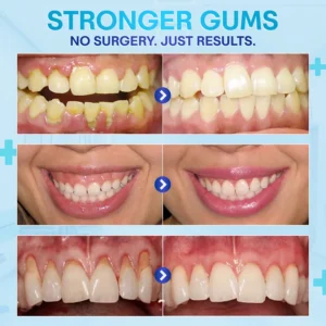 BQYOOM™ Gum Therapy Agent image BQYOOM™ Gum Therapy Agent