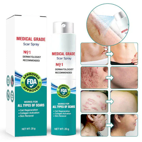 Advanced Scar Spray For All Types of Scars image Advanced Scar Spray For All Types of Scars