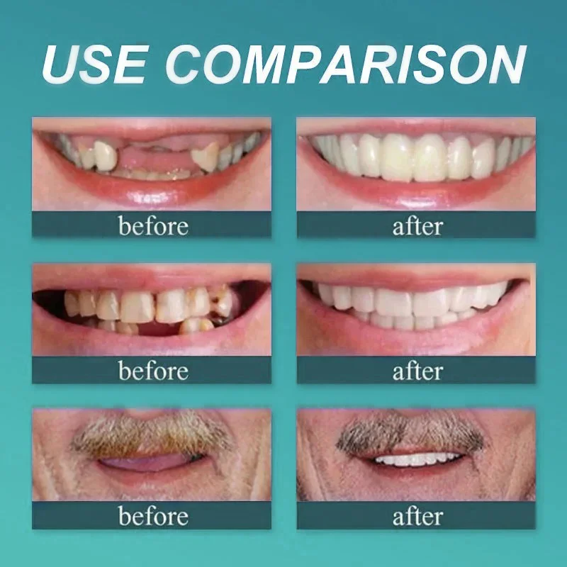 BQYOOM™ Premium Dentures image BQYOOM™ Premium Dentures