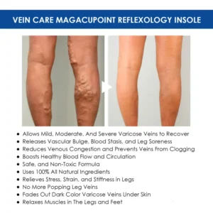 Oveallgo™ VeinCare MagAcupoint Reflexology Insole image Oveallgo™ VeinCare MagAcupoint Reflexology Insole