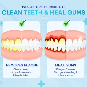 BQYOOM™ Gum Therapy Agent image BQYOOM™ Gum Therapy Agent