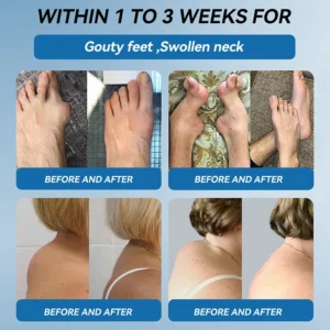 Outeny™ BPC-157 Joint Healing Cream