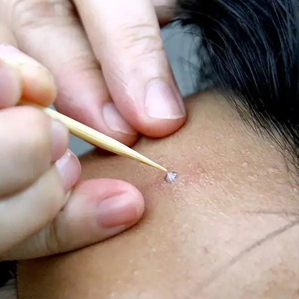 KUBOZN® TagGone Precision Pen image KUBOZN® TagGone Precision Pen