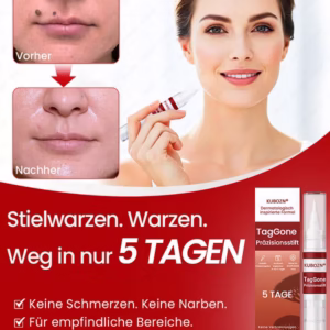 KUBOZN® TagGone Precision Pen image KUBOZN® TagGone Precision Pen