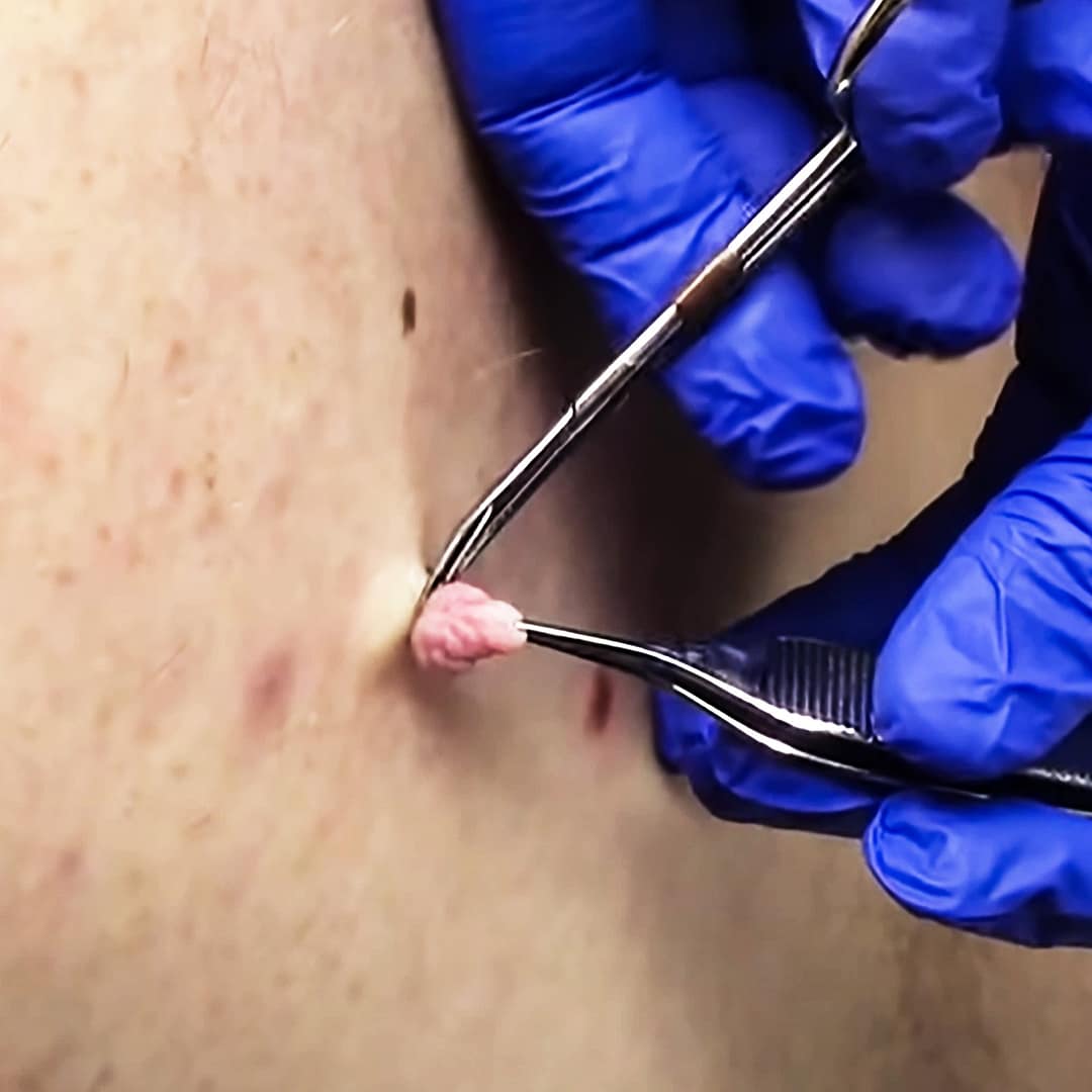 KUBOZN® TagGone Precision Pen image KUBOZN® TagGone Precision Pen