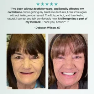 ROSOPL™ Custom-fit, fully functional dentures image ROSOPL™ Custom-fit, fully functional dentures