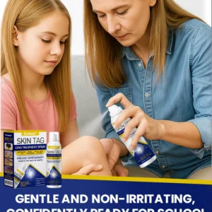 Cvreoz® Skin Tag Cryo Treatment Spray