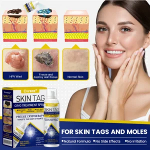 Cvreoz® Skin Tag Cryo Treatment Spray