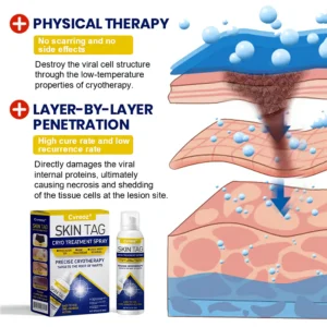 Cvreoz® Skin Tag Cryo Treatment Spray