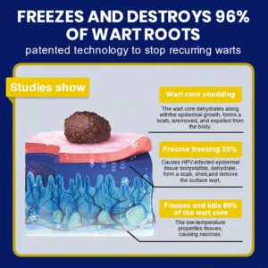 Cvreoz® Skin Tag Cryo Treatment Spray