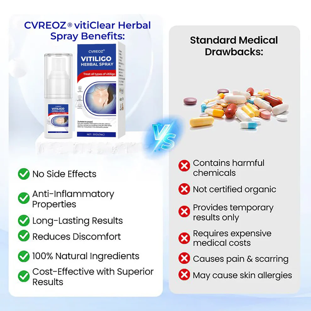 CVREOZ® Vitiligo Herbal Spray image CVREOZ® Vitiligo Herbal Spray