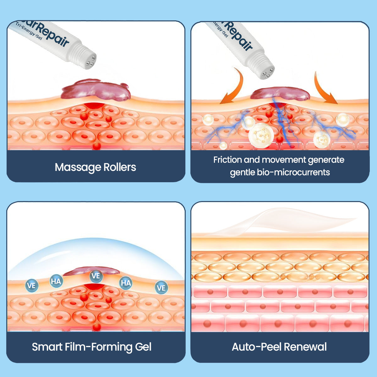 KUBOZN® Triple-Roller Microcurrent ScarRepair Gel image KUBOZN® Triple-Roller Microcurrent ScarRepair Gel