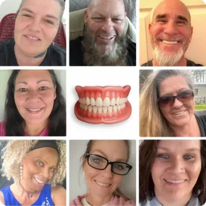 ROSOPL™-Advanced Custom-Fit Functional Dentures