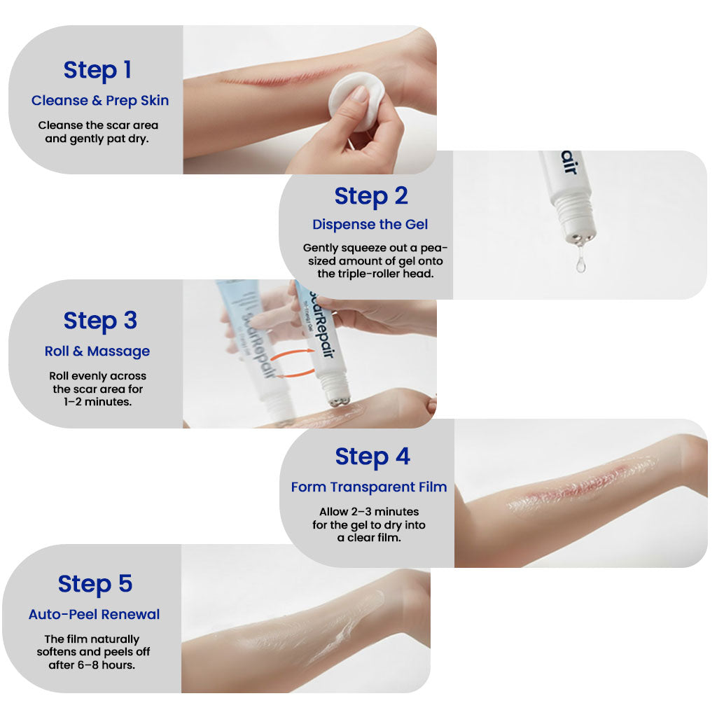 KUBOZN® Triple-Roller Microcurrent ScarRepair Gel image KUBOZN® Triple-Roller Microcurrent ScarRepair Gel