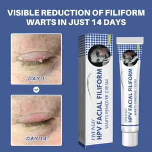 Fivfivgo® HPV Facial Filiform Warts Removal Cream image Fivfivgo® HPV Facial Filiform Warts Removal Cream