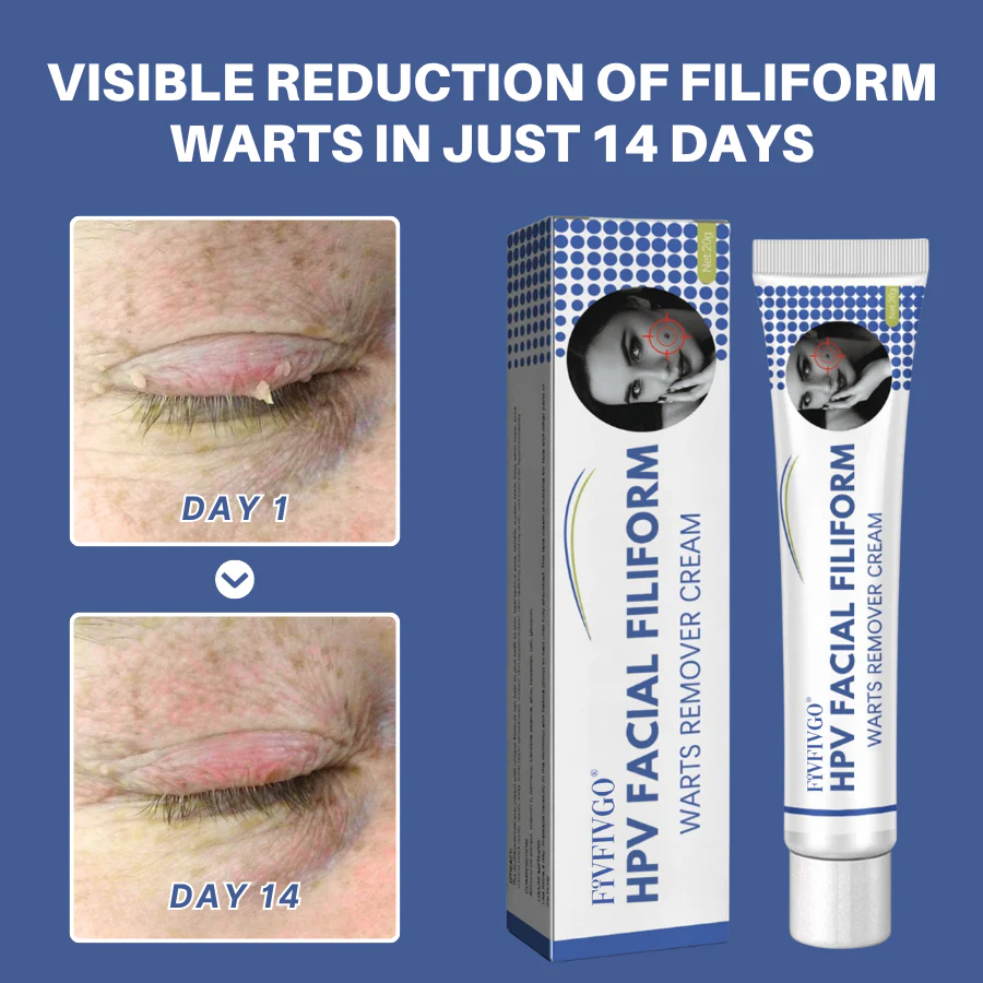 Fivfivgo® HPV Facial Filiform Warts Removal Cream image Fivfivgo® HPV Facial Filiform Warts Removal Cream