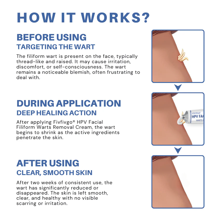 Fivfivgo® HPV Facial Filiform Warts Removal Cream image Fivfivgo® HPV Facial Filiform Warts Removal Cream