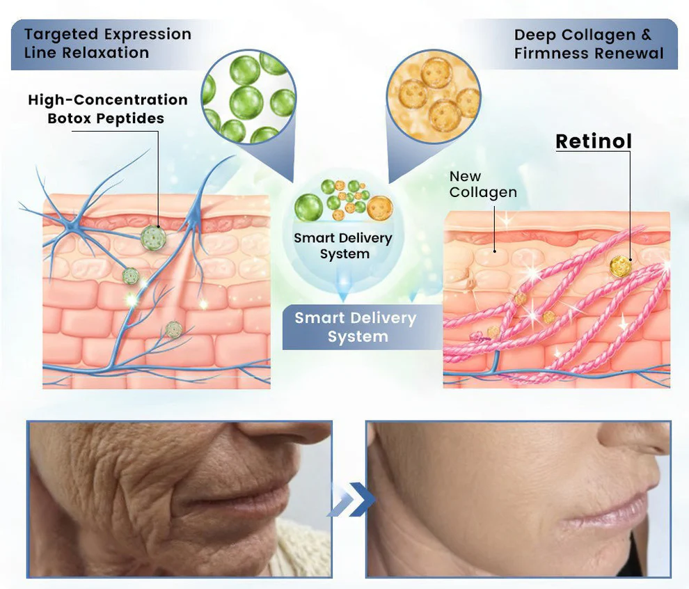 Cheemex® Advanced Botulinum Toxin Peptide Retinol Firming & Lifting Cream image Cheemex® Advanced Botulinum Toxin Peptide Retinol Firming & Lifting Cream