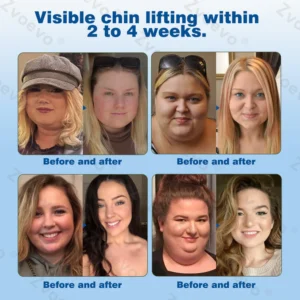 Ourlyardยฎ Tirzepatid Nano Patch