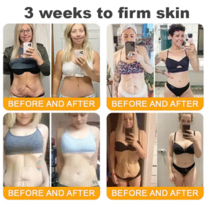 LOVILDS™ Bee Venom Skin Restoration Cream image LOVILDS™ Bee Venom Skin Restoration Cream