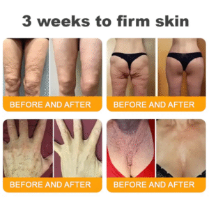 LOVILDS™ Bee Venom Skin Restoration Cream image LOVILDS™ Bee Venom Skin Restoration Cream