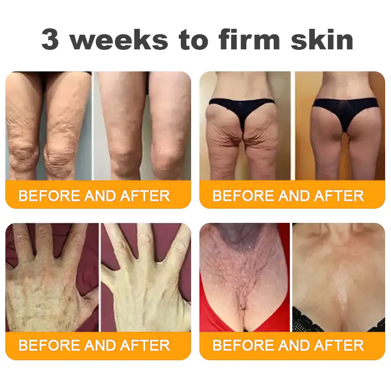 LOVILDS™ Bee Venom Skin Restoration Cream image LOVILDS™ Bee Venom Skin Restoration Cream