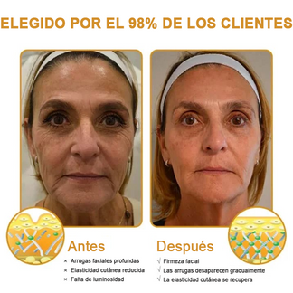 𝐅𝐮𝐫𝐳𝐞𝐫𝐨™ Botox Anti-Wrinkle Cream with Bee Venom image 𝐅𝐮𝐫𝐳𝐞𝐫𝐨™ Botox Anti-Wrinkle Cream with Bee Venom