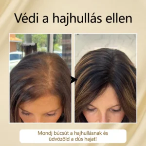 Timilk® VitaStrand Biotin Hair Growth Spray