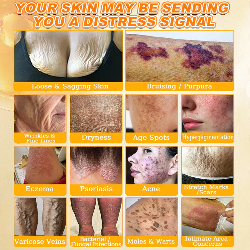 Cheemex® Bee Venom Skin Restoration Cream image Cheemex® Bee Venom Skin Restoration Cream