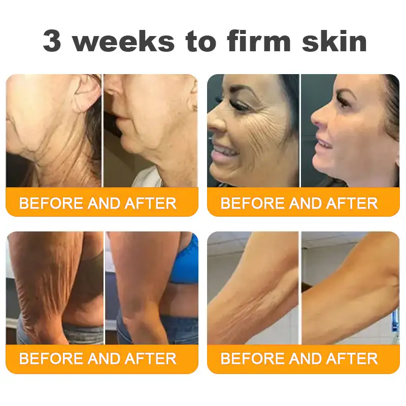 LOVILDS™ Bee Venom Skin Restoration Cream image LOVILDS™ Bee Venom Skin Restoration Cream