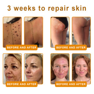 LOVILDS™ Bee Venom Skin Restoration Cream image LOVILDS™ Bee Venom Skin Restoration Cream