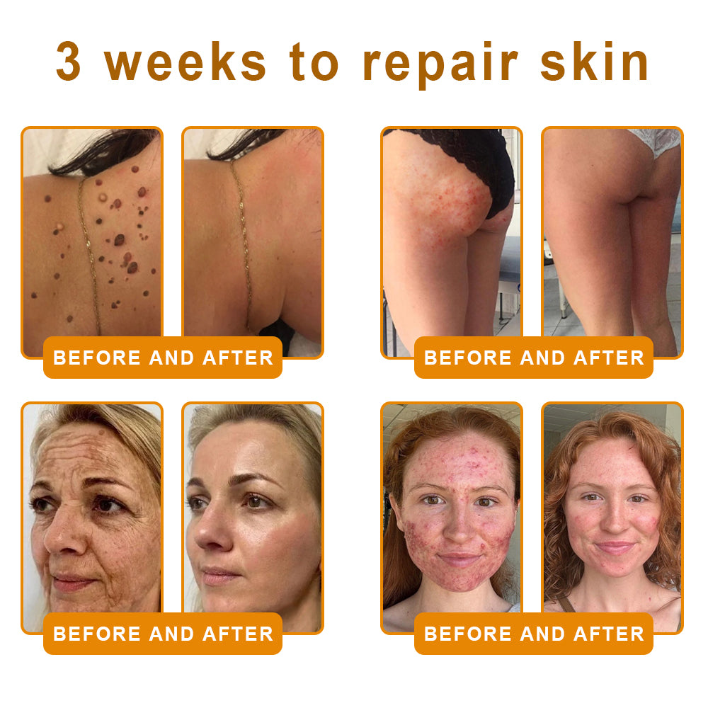 LOVILDS™ Bee Venom Skin Restoration Cream image LOVILDS™ Bee Venom Skin Restoration Cream