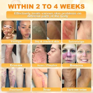 Cheemex® Bee Venom Skin Restoration Cream image Cheemex® Bee Venom Skin Restoration Cream