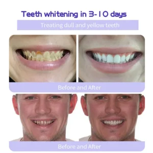 BQYOOM™ Teeth Restorative Mineral Powder image BQYOOM™ Teeth Restorative Mineral Powder