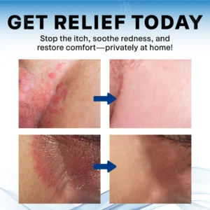 Fivfivgo® Scrotum Itchy Treatment Cream image Fivfivgo® Scrotum Itchy Treatment Cream